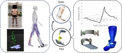 Zum Artikel "Completion of the DFG project on the design of passive, structurally optimized orthoses for the treatment or compensation of pathophysiological movement patterns"